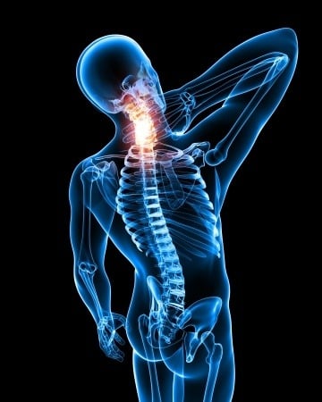 How to relieve neck and shoulder tension yourself for a strained, stiff neck